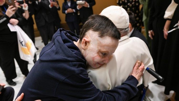 Papa Francisco recibe por tercera vez a niño ucraniano víctima de ataque ruso